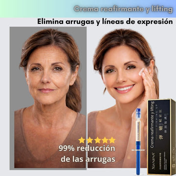 Crema reafirmante y lifting: elimina arrugas en 60 segundos